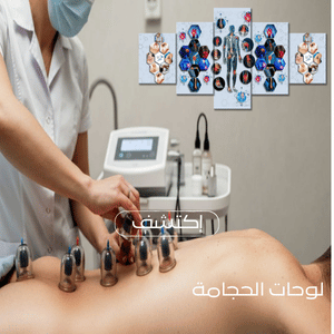 hijama