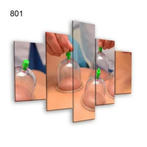 801:لوحة الحجامة من خمس اطارات