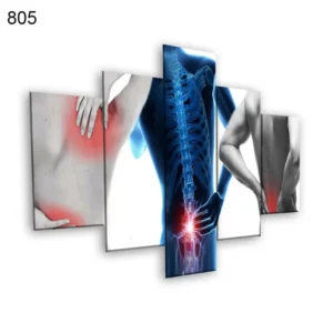 805:لوحة الحجامة من خمس اطارات